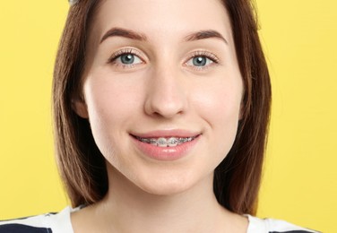 Photo of Portrait of smiling woman with dental braces on yellow background, closeup