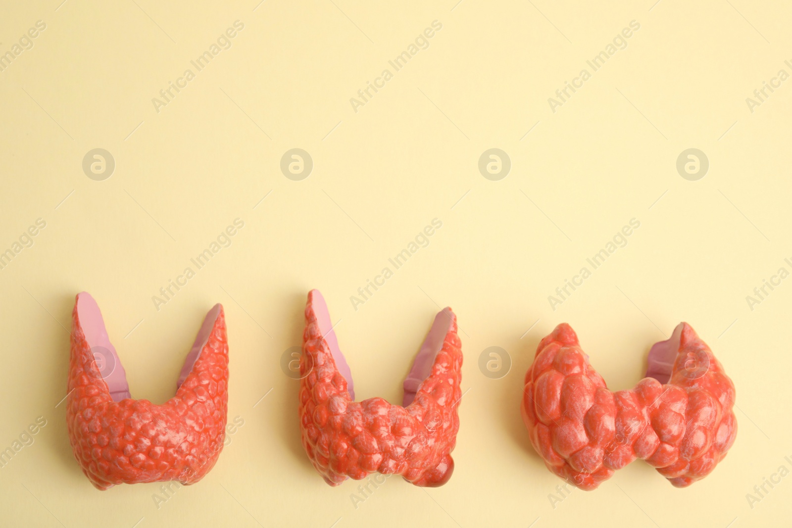 Photo of Plastic models of healthy and afflicted thyroids on beige background, flat lay. Space for text
