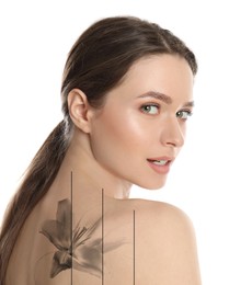 Image of Design with photo of woman on white background during tattoo removal process