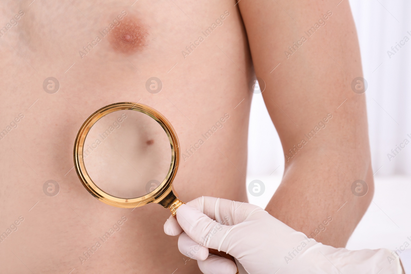 Photo of Dermatologist examining patient with magnifying glass in clinic, closeup view