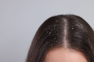 Photo of Woman with dandruff problem on grey background, closeup. Space for text