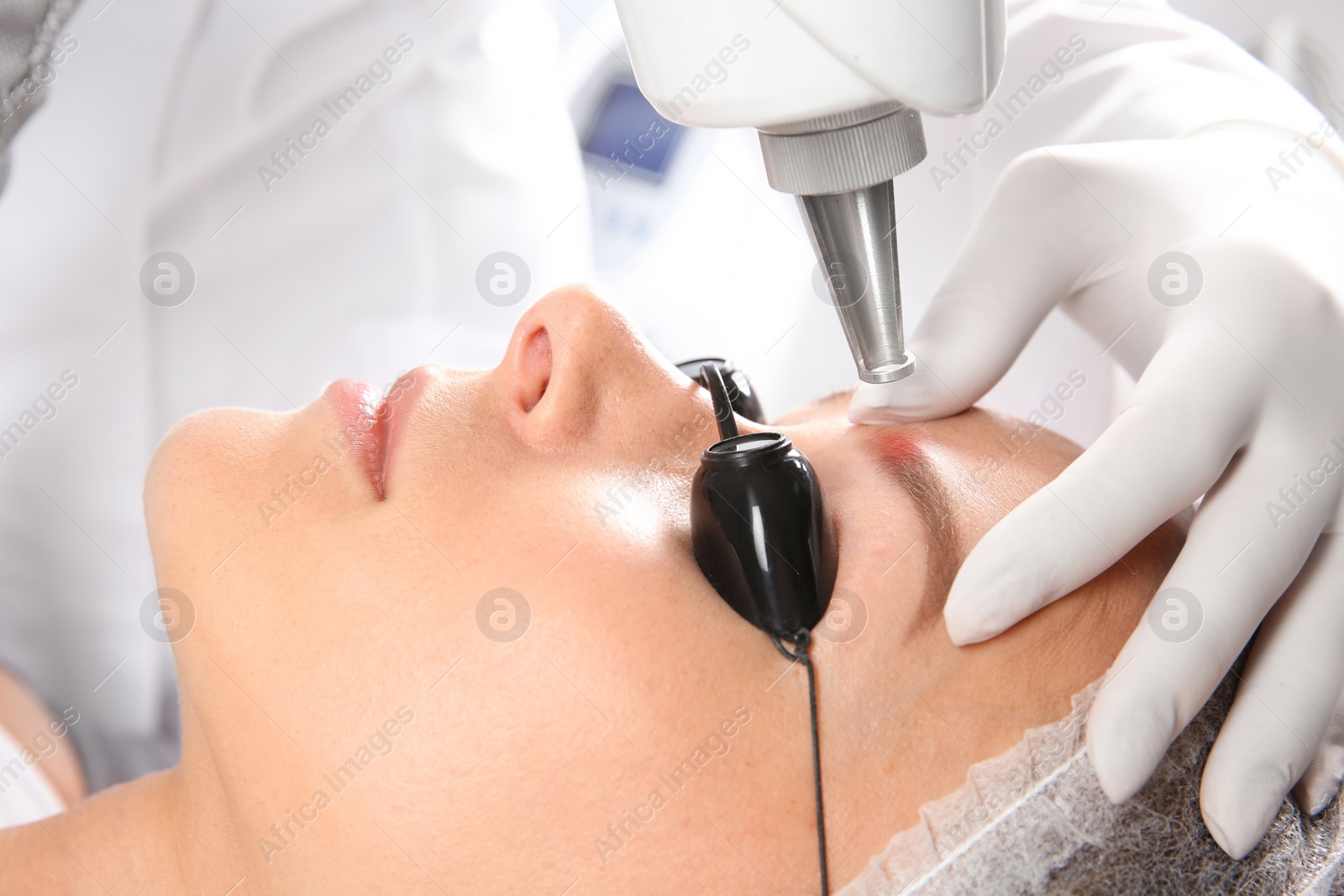 Photo of Young woman undergoing laser removal of permanent makeup in salon. Eyebrow correction