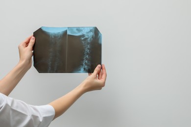 Photo of Doctor examining neck MRI image on light grey background, closeup. Space for text