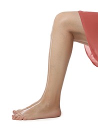 Closeup view of woman with varicose veins on white background