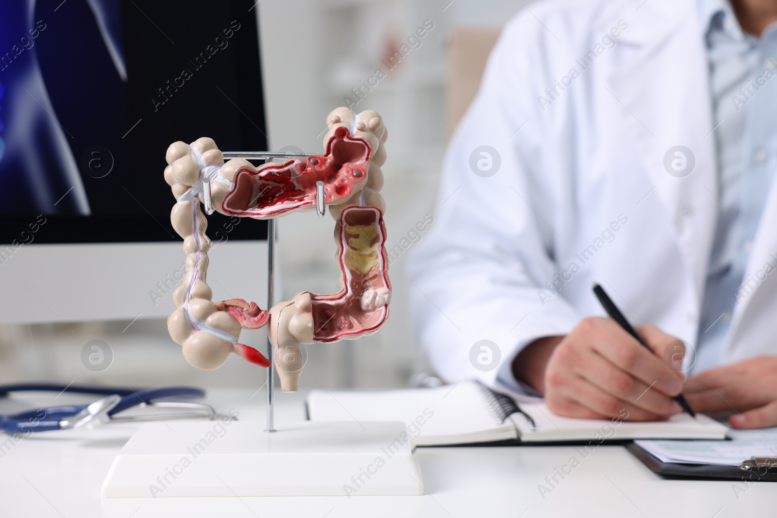 Photo of Gastroenterologist working at table in clinic, focus on anatomical model of large intestine