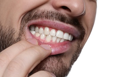 Man showing healthy gums on white background, closeup