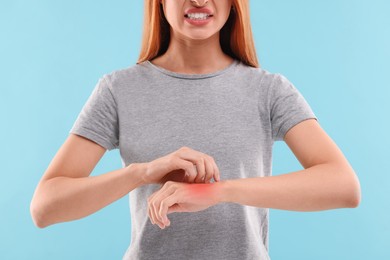 Photo of Suffering from allergy. Young woman scratching her arm on light blue background, closeup