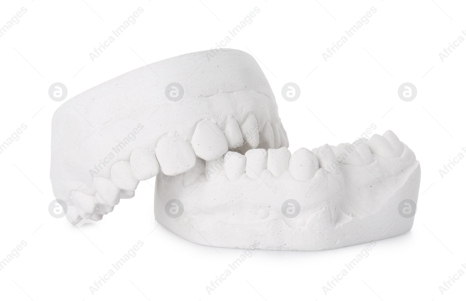 Photo of Dental model with gums isolated on white. Cast of teeth