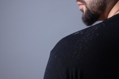 Man with dandruff on his sweater against grey background, closeup. Space for text