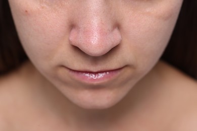 Closeup view of woman with normal skin