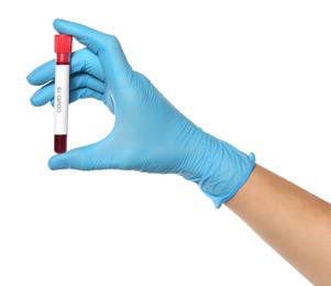 Photo of Scientist in protective gloves holding test tube with blood sample and label Covid-19 on white background, closeup