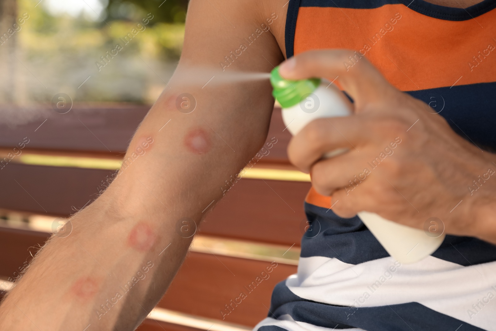 Photo of Man spraying insect repellent on his arm outdoors, closeup