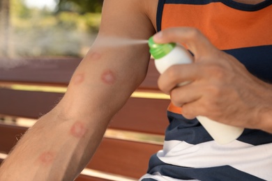 Photo of Man spraying insect repellent on his arm outdoors, closeup