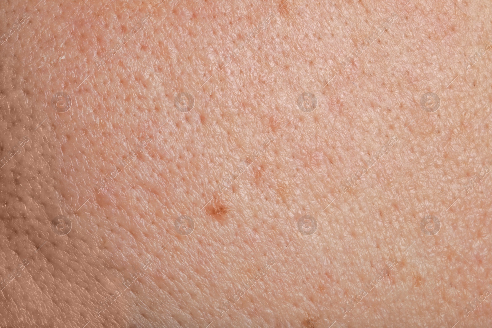 Photo of Closeup view of human skin as background