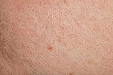 Closeup view of human skin as background