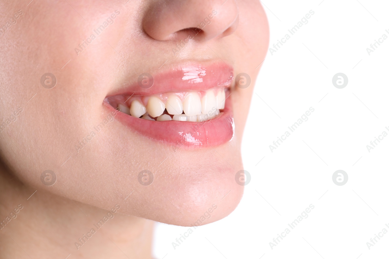 Photo of Young woman with healthy teeth smiling on white background, closeup