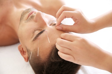 Young man undergoing acupuncture treatment in salon, closeup