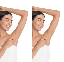 Image of Collage of woman showing armpit before and after epilation on white background