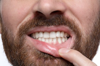 Photo of Man showing healthy gums on white background, closeup