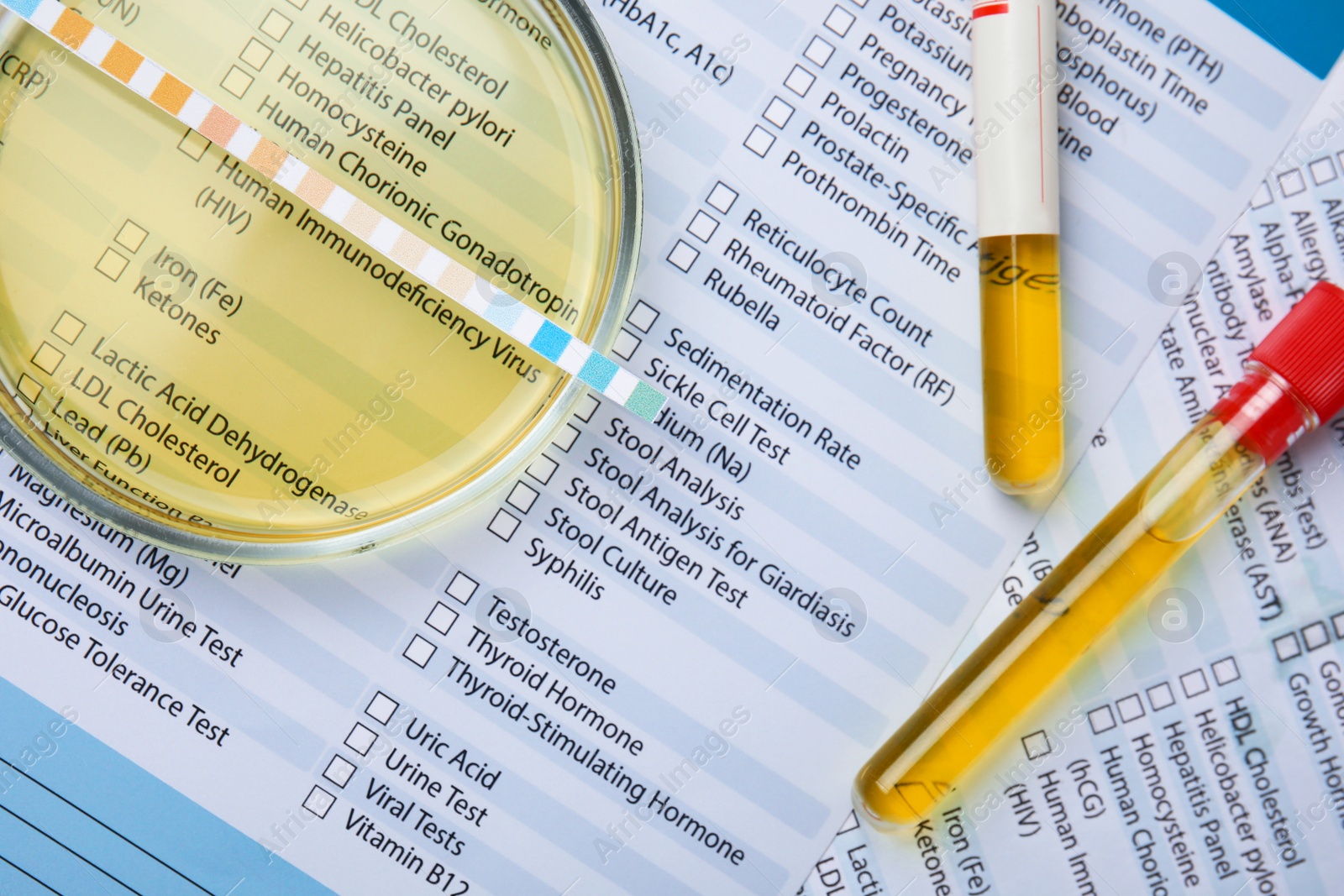 Photo of Petri dish with urine sample for analysis on laboratory test form, flat lay