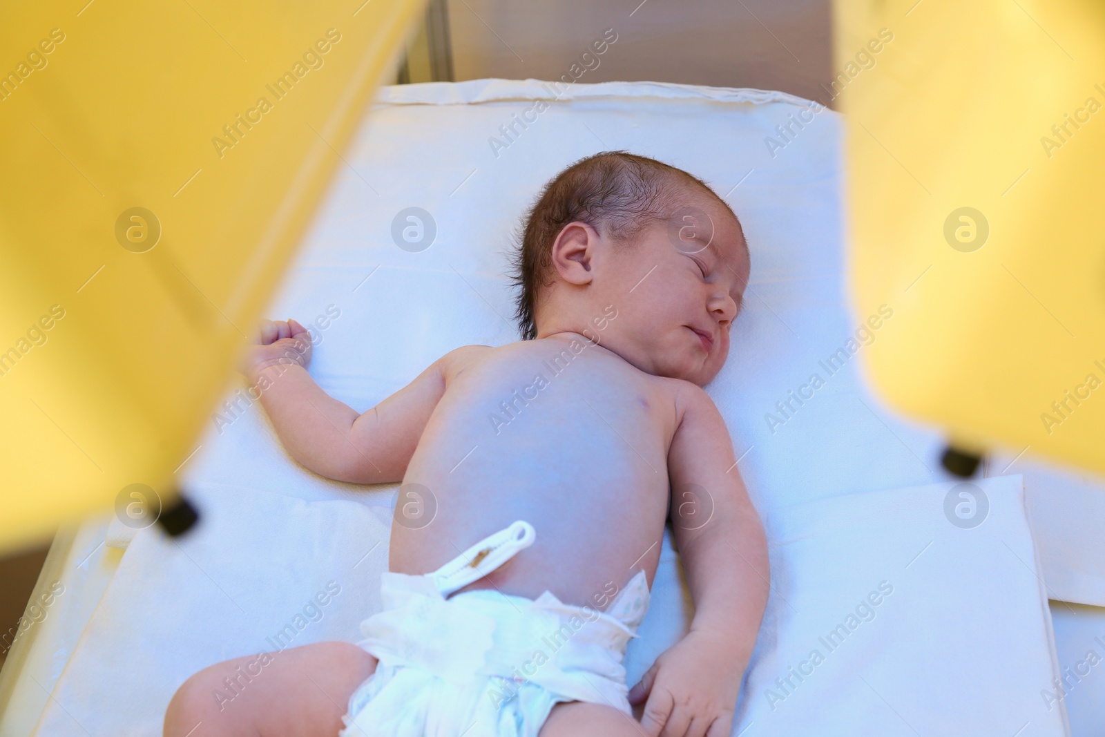 Photo of Newborn child under ultraviolet light in hospital