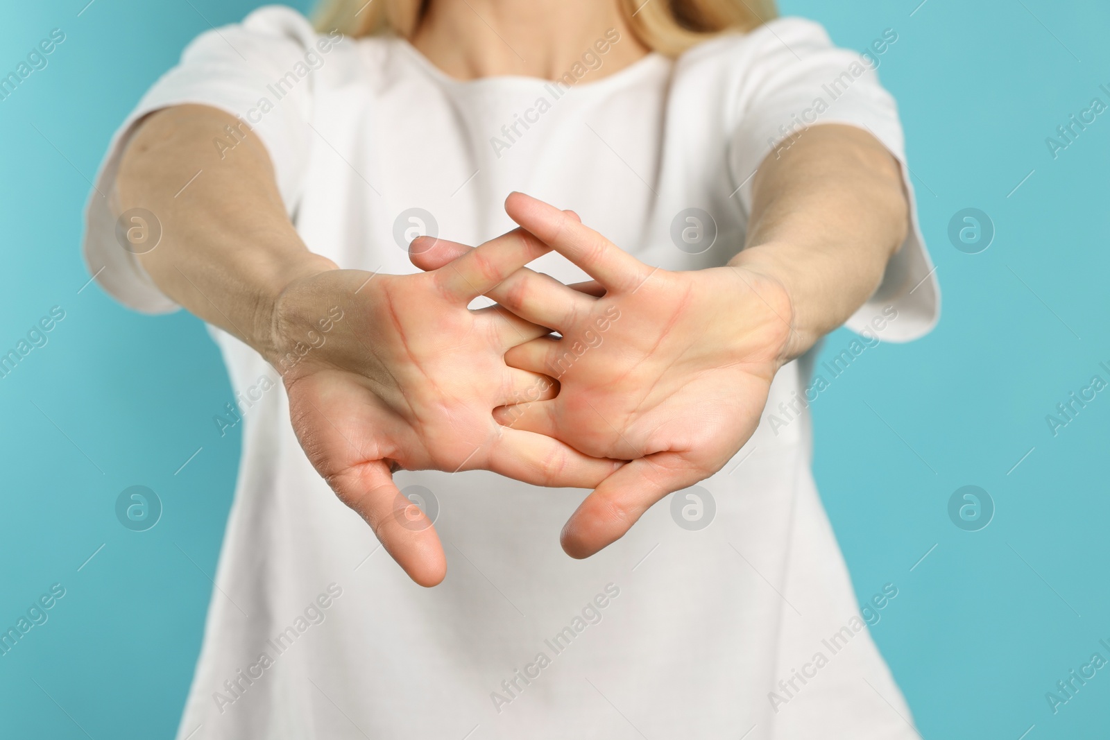 Photo of Woman cracking her knuckles on turquoise background, closeup. Bad habit