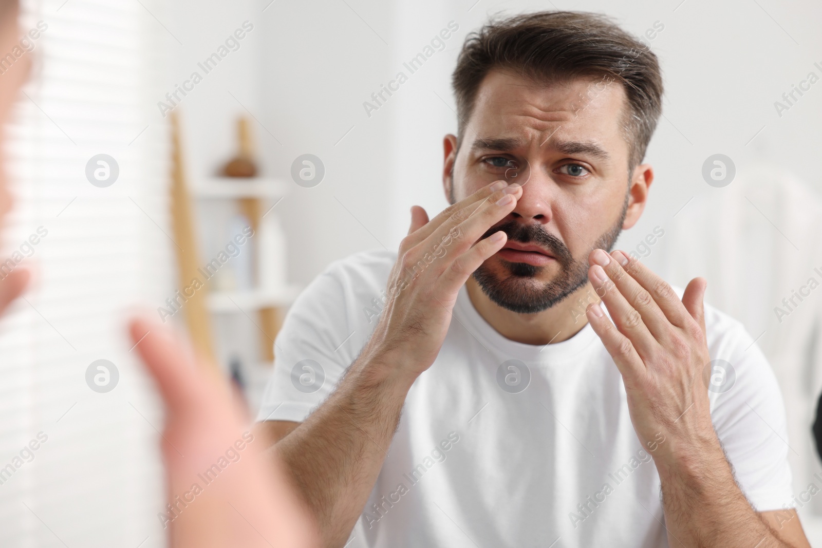 Photo of Confused man with skin problem looking at mirror indoors