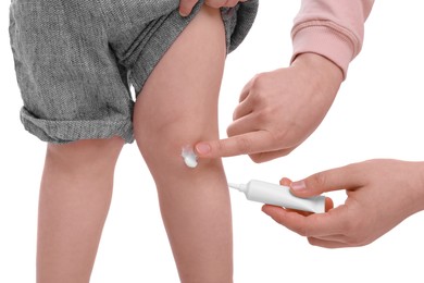 Photo of Mother applying ointment onto her son`s knee on white background, closeup