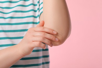 Photo of Woman applying ointment onto her elbow on pink background, closeup