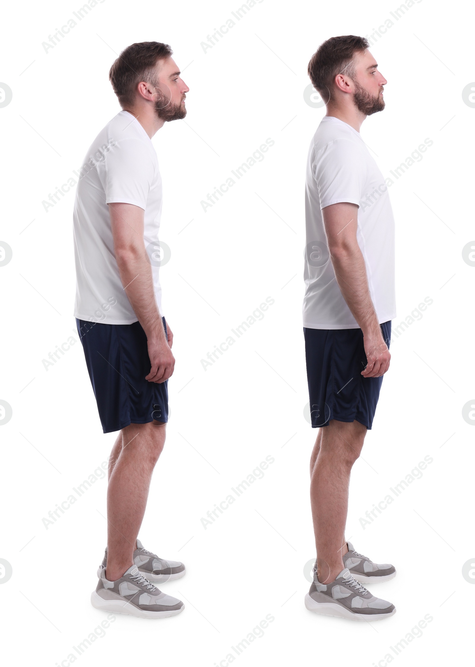 Image of Collage with photos of young man with poor and good posture on white background