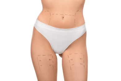 Photo of Slim woman with markings on body before cosmetic surgery operation on white background, closeup