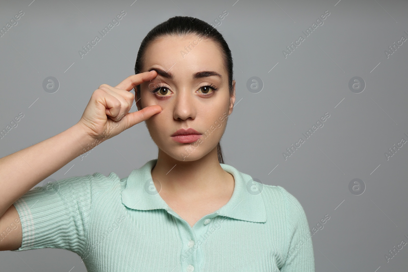 Photo of Woman checking her health condition on grey background. Yellow eyes as symptom of problems with liver