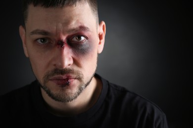 Man with facial injuries on dark background, space for text. Domestic violence victim