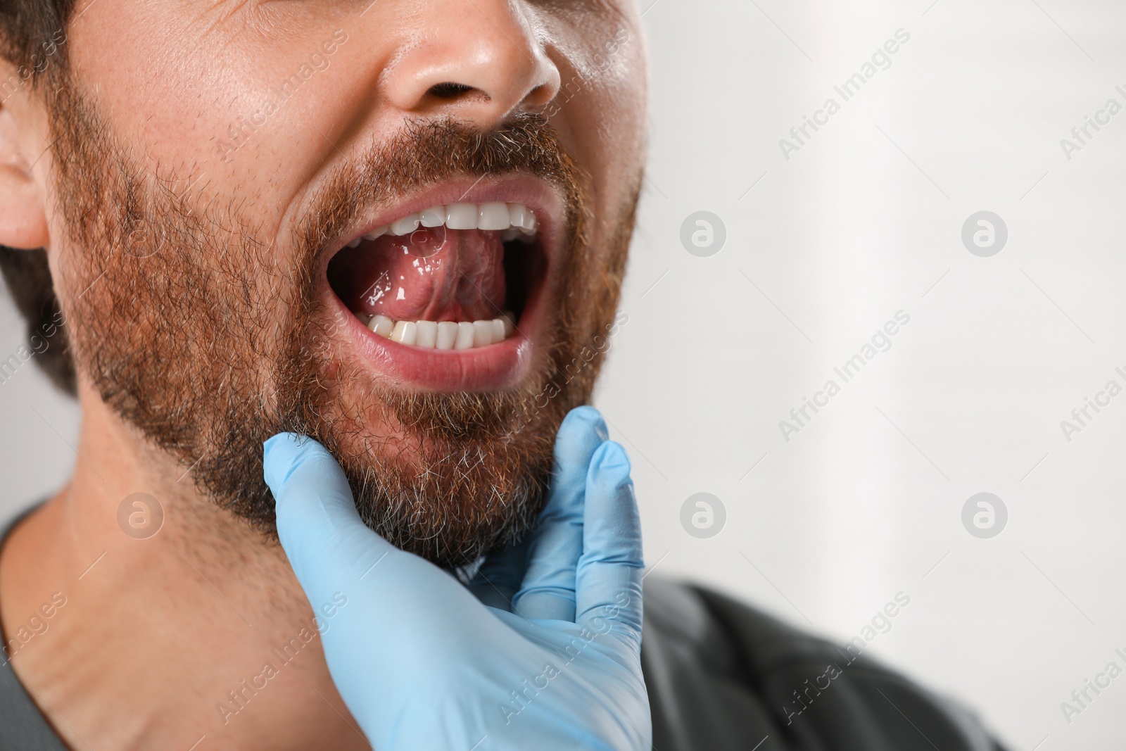 Photo of Doctor in medical gloves examining man`s oral cavity on blurred background, closeup