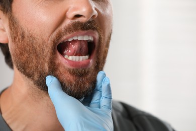 Doctor in medical gloves examining man`s oral cavity on blurred background, closeup