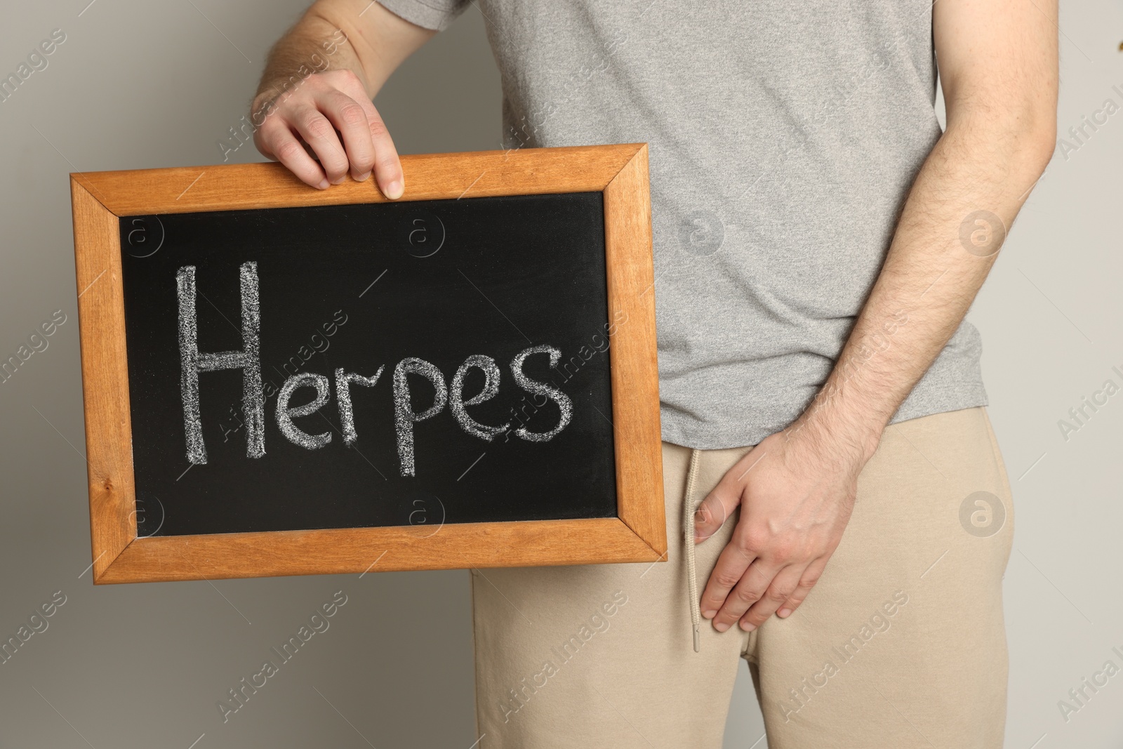 Photo of Man holding small chalkboard with word Herpes on beige background, closeup