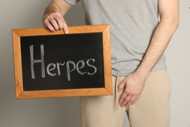 Photo of Man holding small chalkboard with word Herpes on beige background, closeup