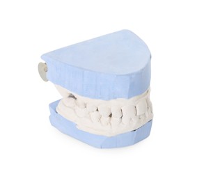 Dental model with gums isolated on white. Cast of teeth