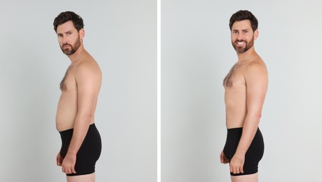 Image of Collage with portraits of man before and after weight loss on light background