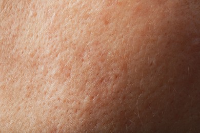 Closeup view of human skin as background