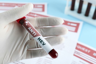 Photo of Scientist holding tube with blood sample and label Anti HEV near laboratory test form, closeup