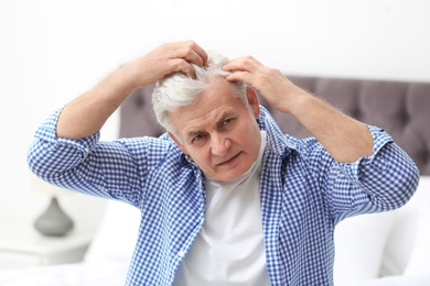 Senior man with hair loss problem indoors