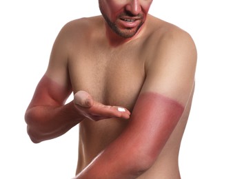 Photo of Man applying cream on sunburn against white background, closeup