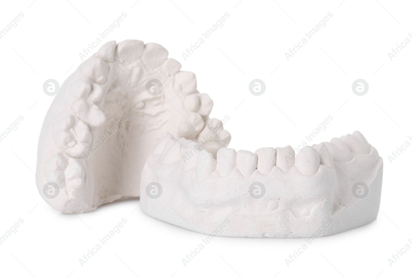 Photo of Dental model with gums isolated on white. Cast of teeth