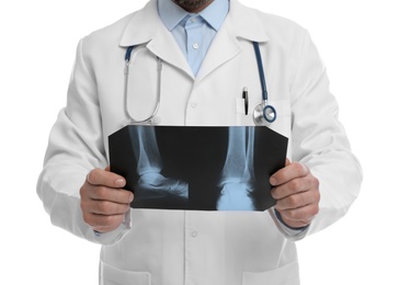Photo of Orthopedist holding X-ray picture on white background, closeup