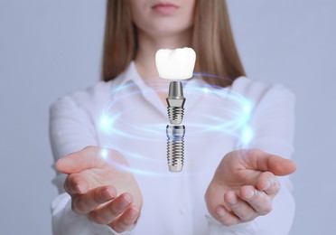 Woman demonstrating dental implant on light background, closeup