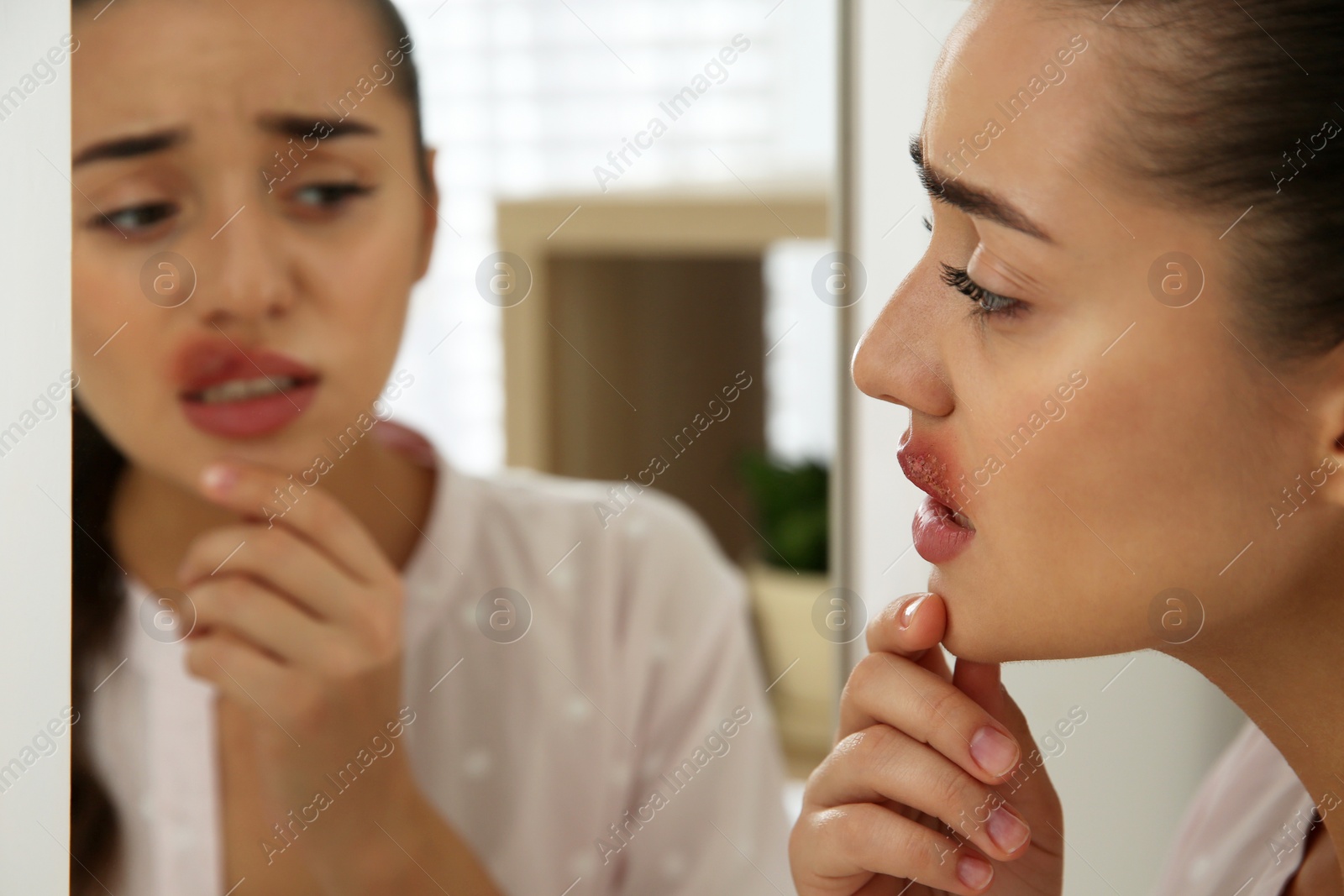 Photo of Young woman with herpes on lip in front of mirror at home