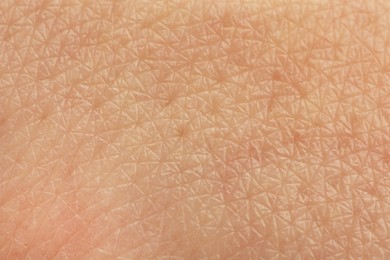 Photo of Texture of dry skin as background, macro view