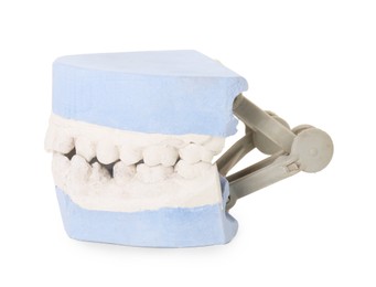 Photo of Dental model with gums isolated on white. Cast of teeth