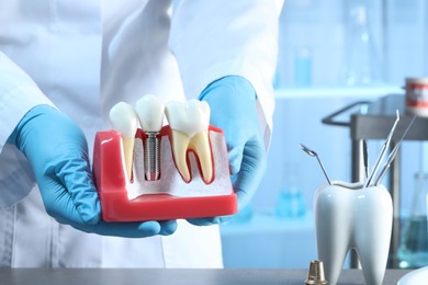 Dentist holding educational model of gum with dental implant between teeth indoors, closeup